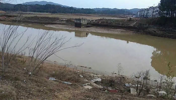 海南旅游预见美 -- 激光去黑眼圈,拥有好眼色‘mk体育’(图1) mk体育
